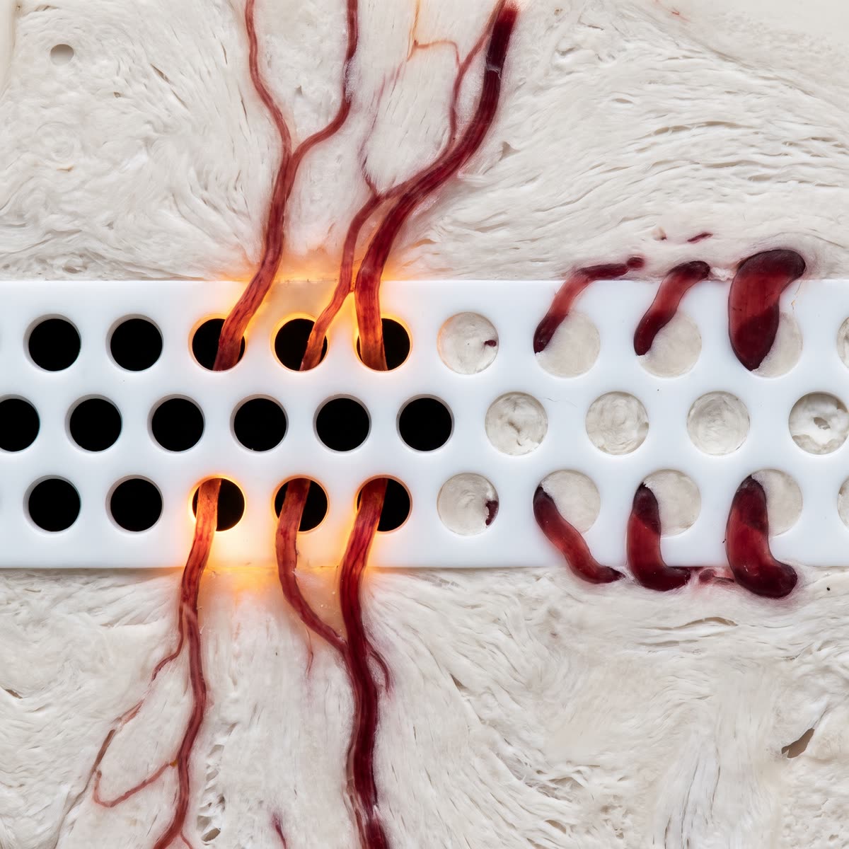Gated channels
